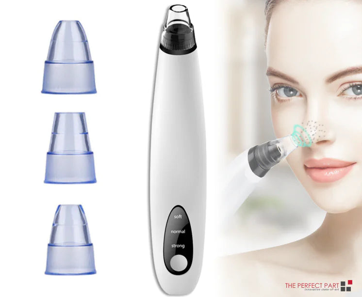 Blackhead Remover - Assortique Inc.